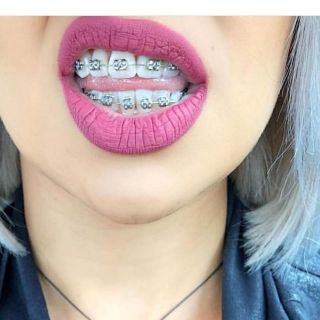 Viral Fake Braces Fashion Trending Shopee Malaysia