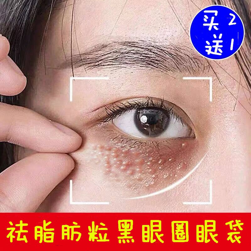现货 眼部救星女神去脂肪粒黑眼圈眼霜去眼袋淡化细纹去鱼尾纹抗皱补水 5月10日发完 Shopee Malaysia