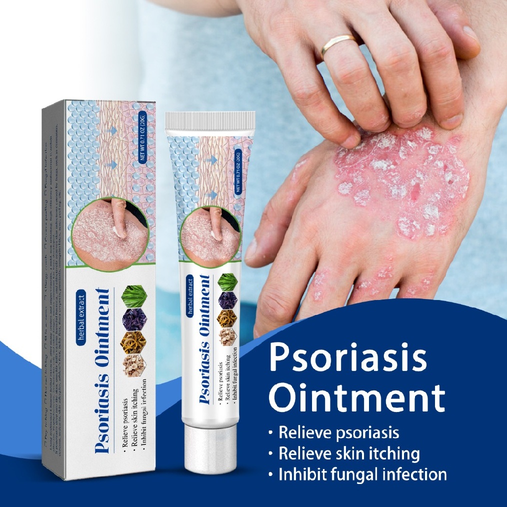20g Skin Care Ointment Body Psoriasis Eczema Pruritus Treatment Cream