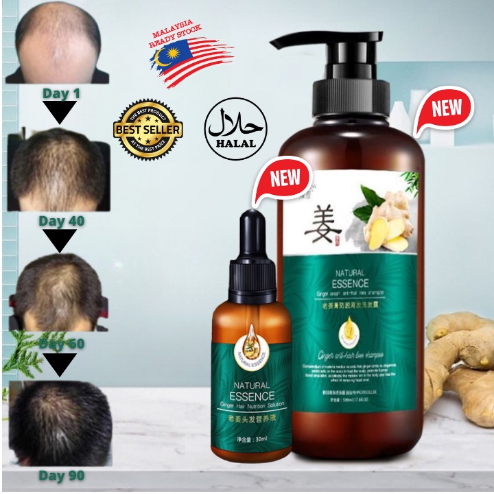 🔥KL STOCK🔥 Ginger King Hair Growth Serum 7 Days Essence + Ginger Shampoo  | Shopee Malaysia