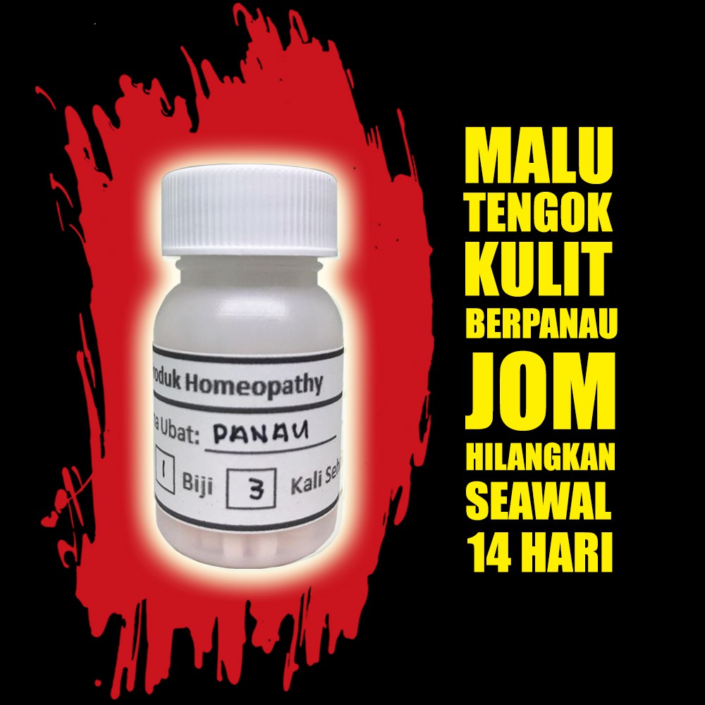 Ubat Nak Hilangkan Panau - Contoh Moo