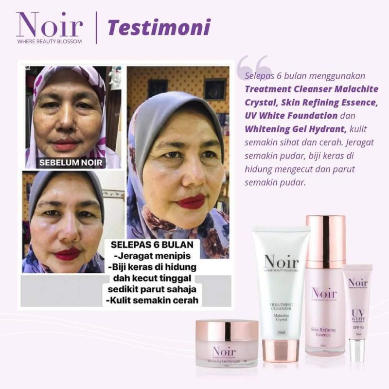 noir skincare testimoni