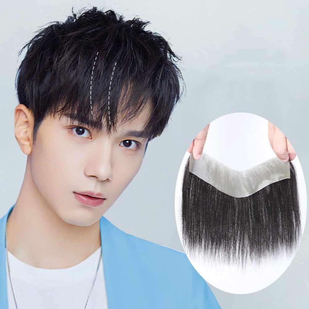 DuoXiu Hairline Wig Stickers Front Toupee Men's Invisible Biological Scalp  Bangs Real Hair V-Style Piece of Stealth Posted Forehead Thin Pu Skin Base  | Shopee Malaysia