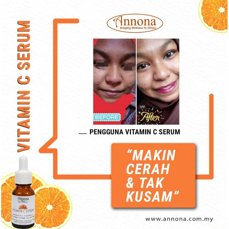 Vitamin C Serum 5ml Annona Skincare Rawatan Parut Jerawat Jeragat Shopee Malaysia