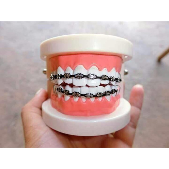 Click Braces Murah Viral Shopee Malaysia