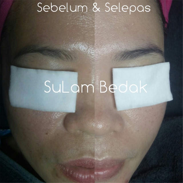 BB Glow Treatment (Sulam Bedak)  Shopee Malaysia