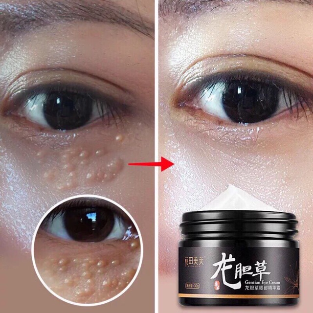 Gentian Eye Cream Hilangkan Biji Kolestrol Hitam Bawah Mata Bengkak Mata Eyebag Kedut Anti Penuaan Shopee Malaysia