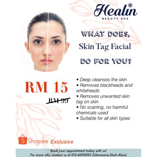 Skin Tag Facial Treatment by Healin - NO EXPIRY