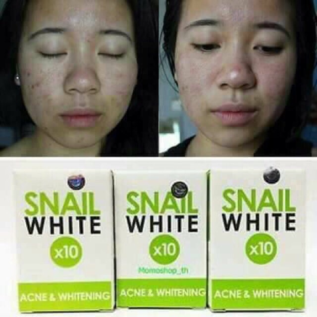 snail white acne soap benefits