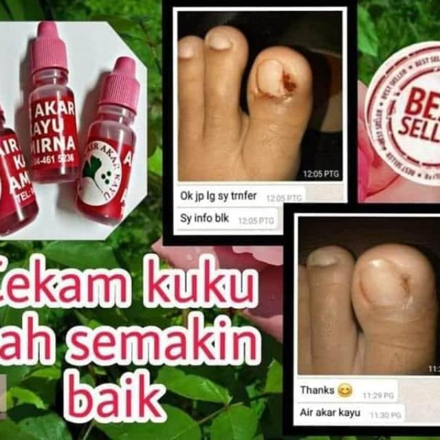 UBAT PENYAKIT KULIT DAN KUKU(AMIRNA MULTIPURPOSE WATER@AIR 