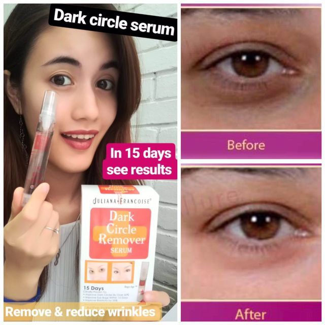 dark circle eye remover