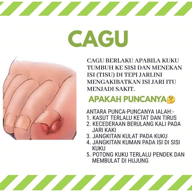 Ubat Kuku Cagu Cengkam Nanah Bengkak Mpc Shopee Malaysia