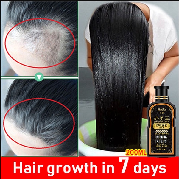 Fall Black Hair Regrowth Shampoo Silicone Free Curly Hair Moisturizing