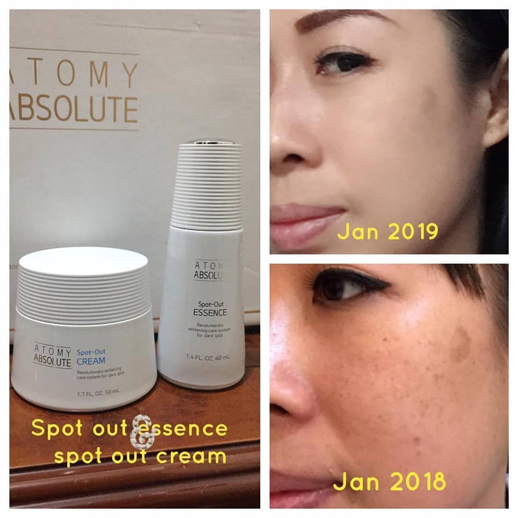 Absolute Spot Out Cream 50ml