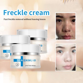Melaquin Cream 4 20g W W With Sunblock Spf25 Shopee Malaysia