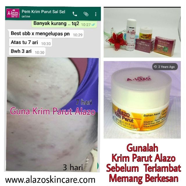 Krim Muka untuk putih cerah Parut bekas jerawat atau ...