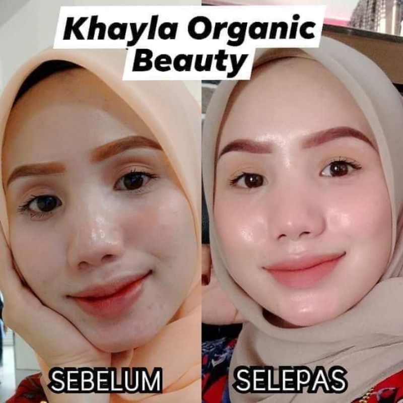 🔥READY STOCK 🔥SCRUB MUKA TERBAIK Shopee Malaysia