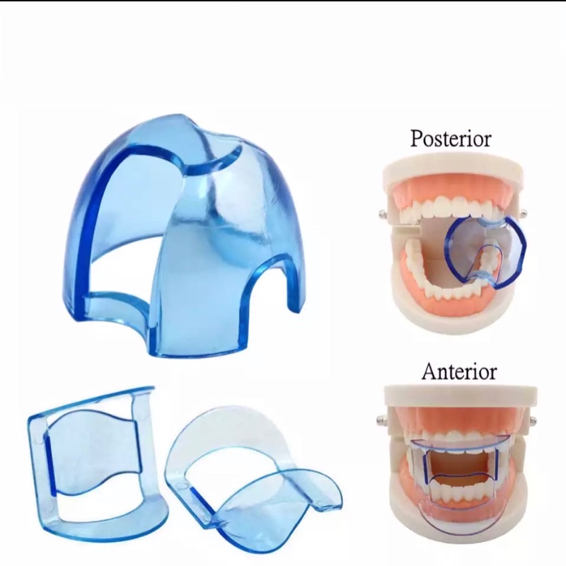 Dental Bite Block Anterior Posterior Teeth/Dental Biteblock Retainer