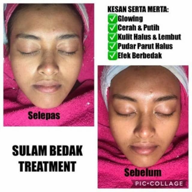 Korea Sulam Bedak Sulam Blusher Bb Glow Face Glowing Treatment Sell By Piece Not One Box Shopee Malaysia