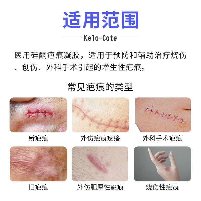 Remove scar南京同仁堂疤痕硅酮修复膏凝胶去凹凸巴克增生祛除神器痘印 
