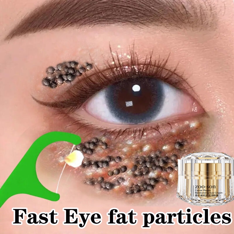 Eye Cream Krim mata Anti-wrinkle Remove eye bags 眼霜祛黑眼圈眼袋脂肪粒 wrinkles dark circles puffiness lift skin Caviar Eye Cream