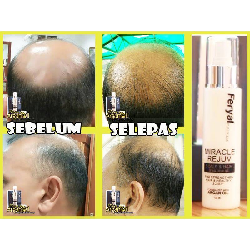 Feryal Argan Oil Packaging Baru Original Untuk Masalah Rambut Gugur Freegift Free Postage Shopee Malaysia