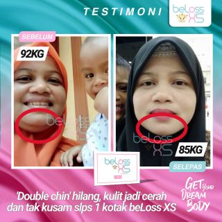 BELOSS XS PRODUK UBAT UNTUK KURUS KURUSKAN TURUN TURUNKAN 