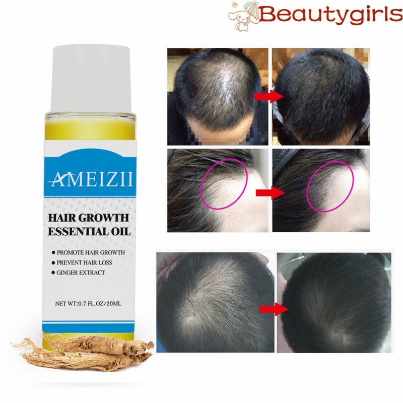 Ameizii Natural Hair Growth Essential Oil Ginger Ginseng Extract