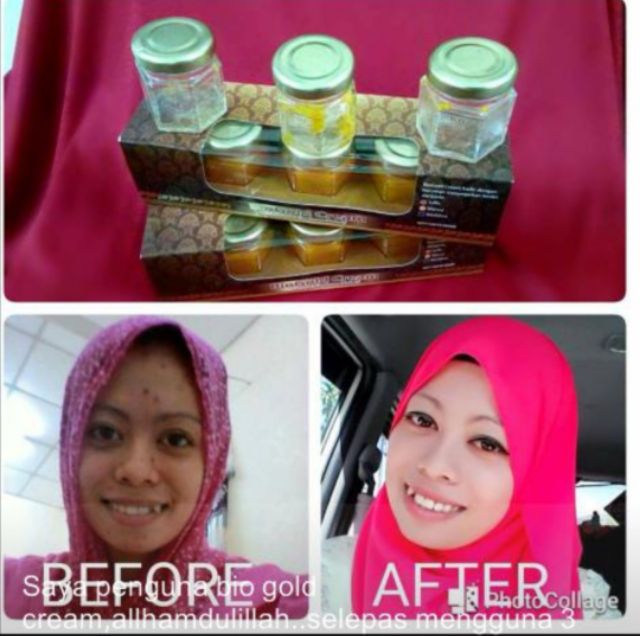 Ready Stok Bio Gold Cream Bam Cendawan Mekah Shopee Malaysia