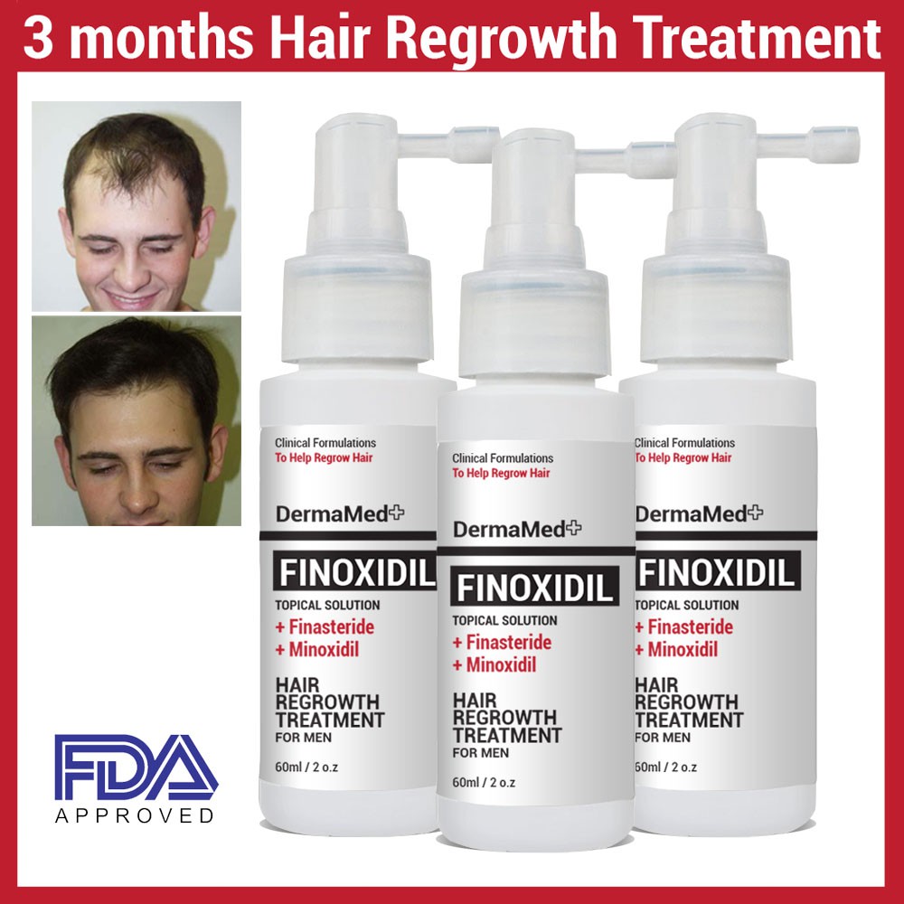 Minoxidil Finasteride Hair Growth Treatment Finoxidil 3x 60ml Shopee Malaysia