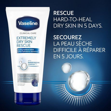 vaseline lotion for very dry skin