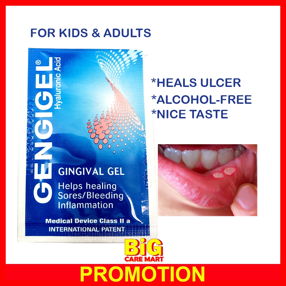 Gengigel Gel 1ml Sachet (Mouth Ulcer Medication) Shopee Malaysia