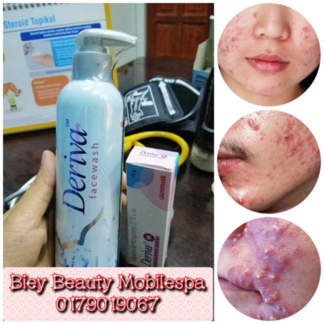 Deriva Face Wash Salicyclic Acid 1 5 Shopee Malaysia