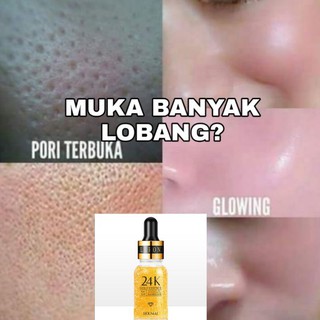 Hilangkan Parut Teruk Buy 1 Free 1 Hilangkan Parut Jerawat Ubat Jerawat Ubat Jeragat Ubat Putihkan Kulit Viral Shopee Malaysia