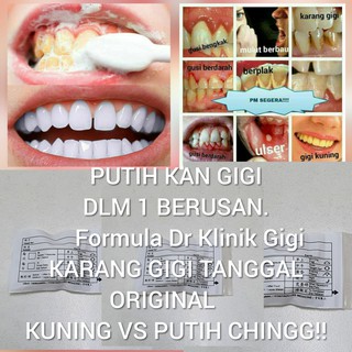 100% ORIGINAL BAKING SODA WHITENING TOOTHPASTE PEMUTIH 