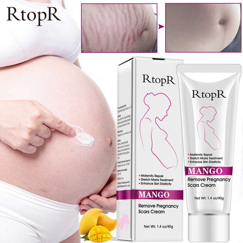 rtopr stretch mark cream