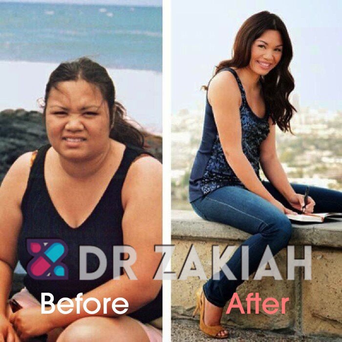 Formula Kurus Dr Zakiah Shopee Malaysia