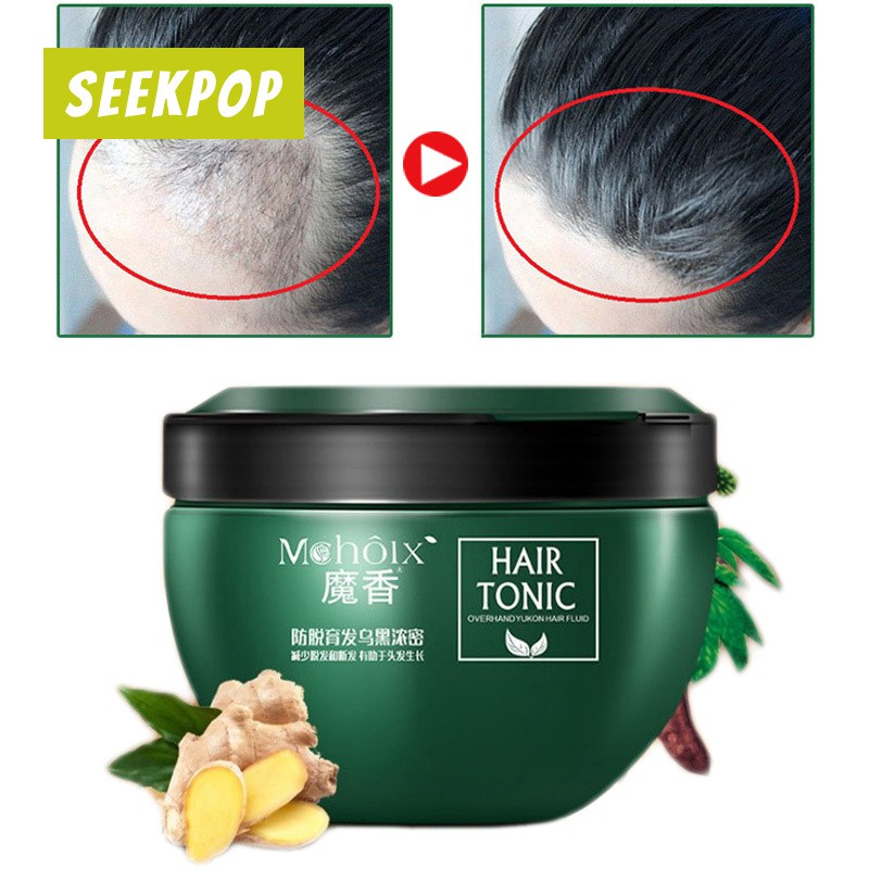 Men Women Hair Loss Treatment Hair Regrowth Treatment Tonic Cream