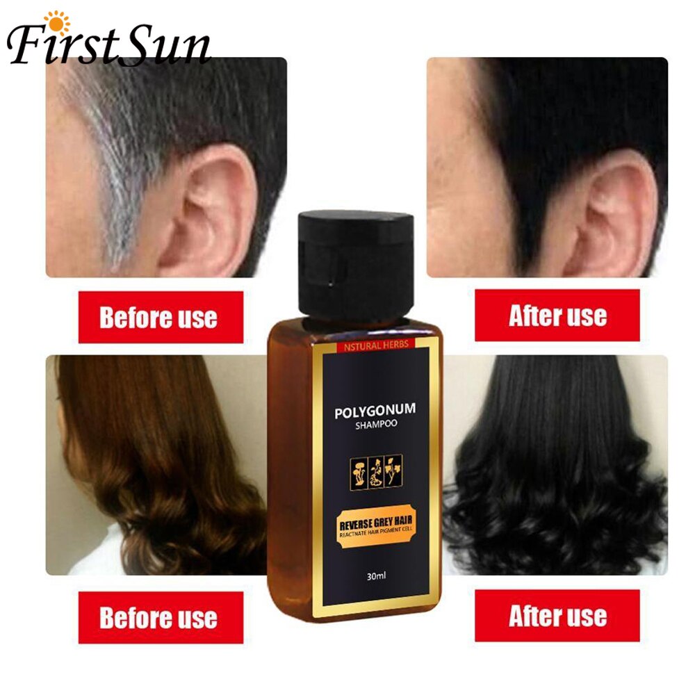 30ml Black Hair Shampoo Grey Reverse Hair Color Shampoo Anti Gray Hair  Treatment White Removal Natural Herbal Hair Dye Care | Shopee Malaysia