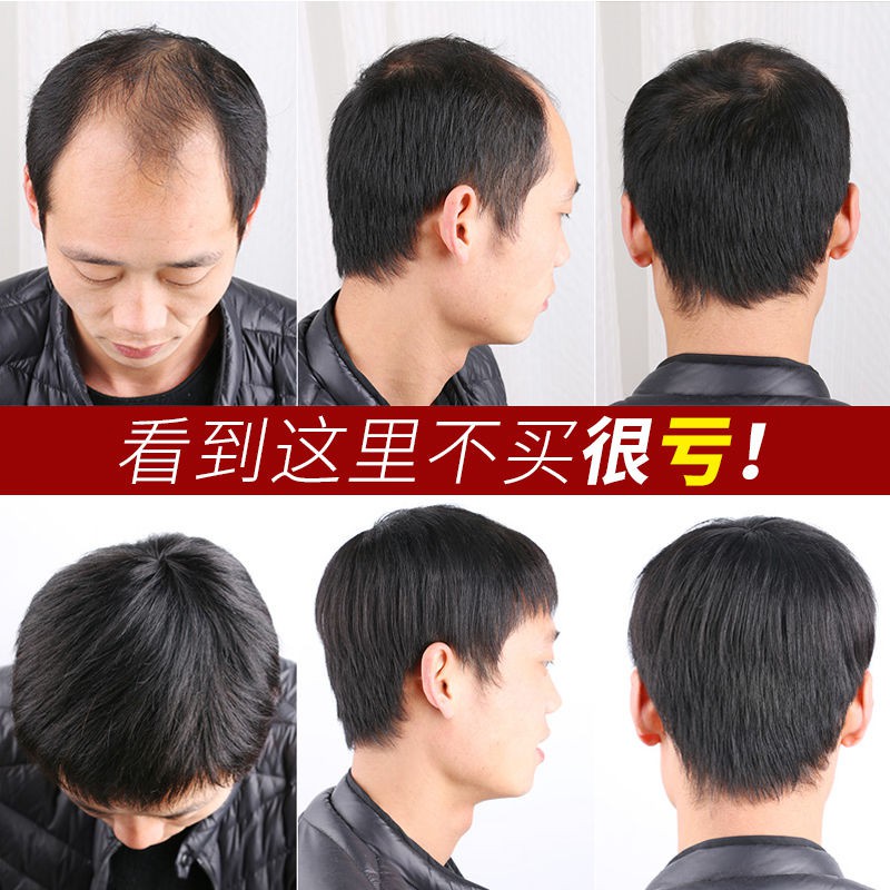 Wig Male Head Replacement Piece Top Hair Forehead Bald Weave Men