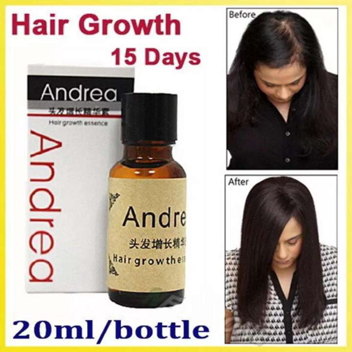 hair loss treatment malaysia