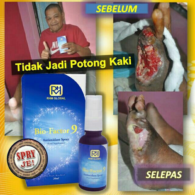 Spray Bio Factor 9 Elak Kaki Dipotong Ubat Kencing Manis Diabetis Shopee Malaysia