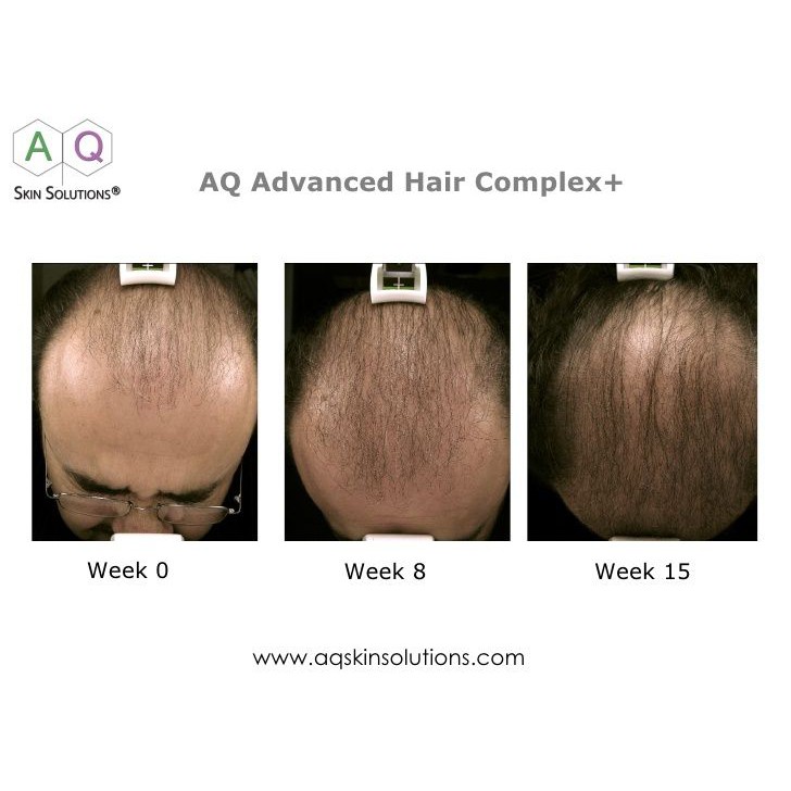 Top 148 + Facial hair problems and solutions polarrunningexpeditions