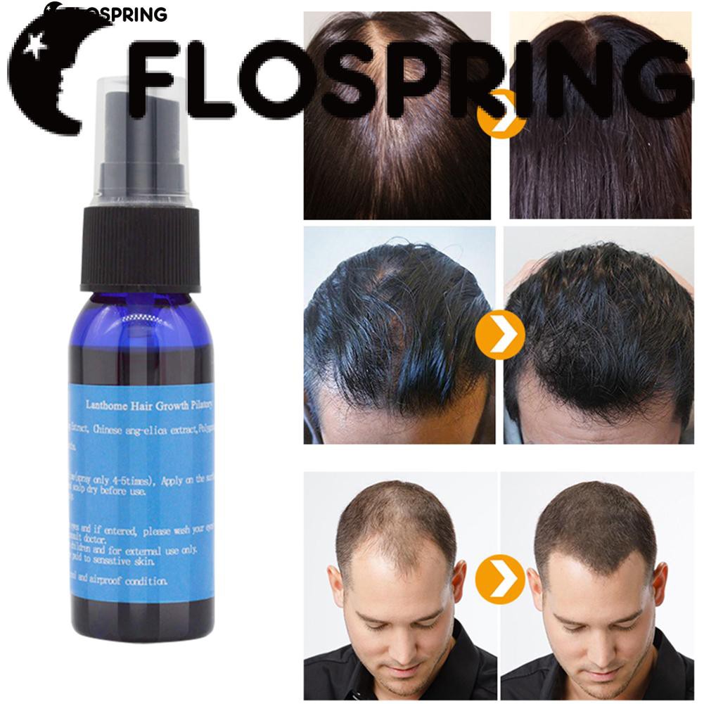 Fast Hair Growth Dense Regrowth Essence Treatment Men Anti Loss