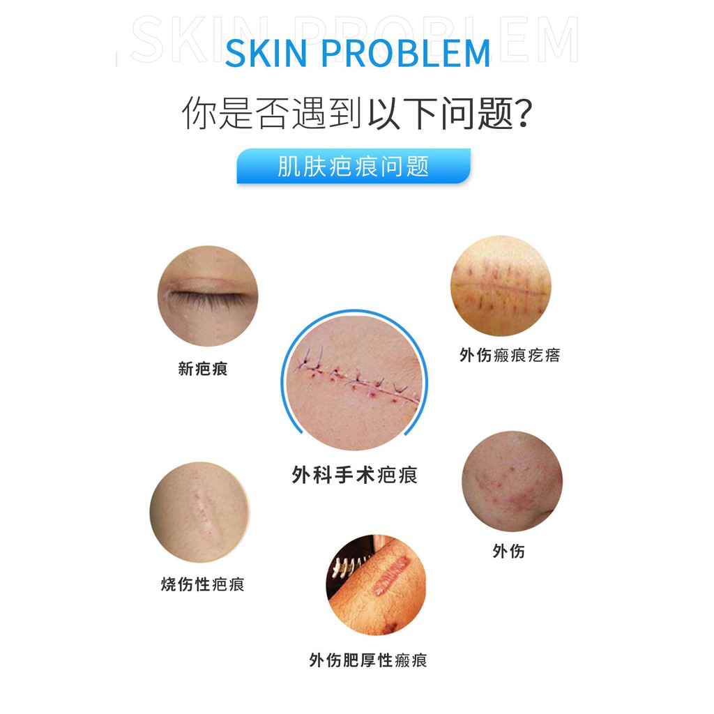 Remove scar芭克旗舰店疤克疤痕修复剖腹产非祛疤膏巴克硅凝胶伤痕美国 
