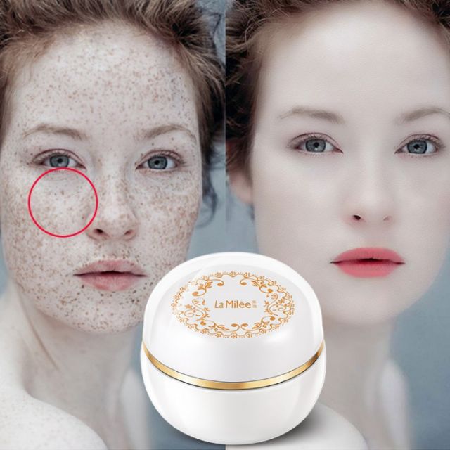 bioaqua freckle cream