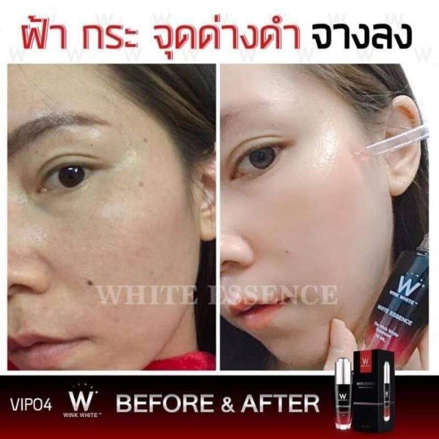 Wink White White Essence Shopee Malaysia