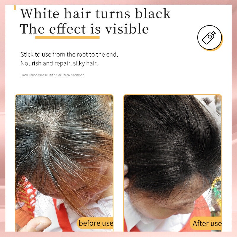 Ready Stock】 300ml Polygonum Multiflorum Shampoo White Hair Turns Black  Herbal Natural Nourishing Hair Treatment Shampoo