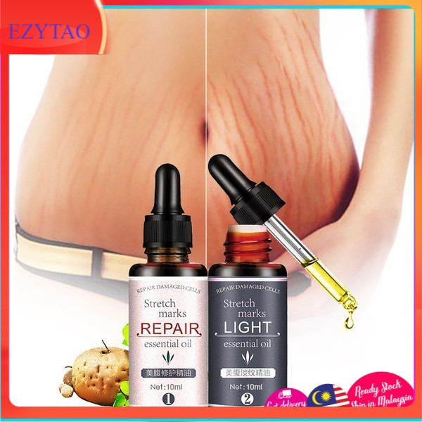 2 in 1 Skin Stretch Mark Removal Essential Oil Postpartum Loose Skin Repair 30ml