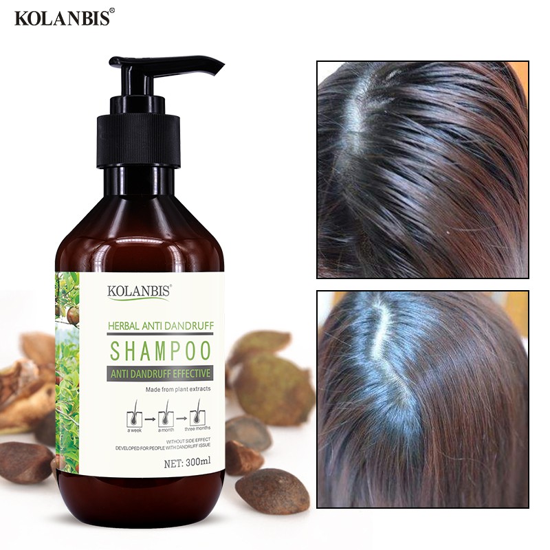 Oily Hair Shampoo Reduce Hair Fall Anti Itch Cure Oily Scalp Hair Oil  Control Treatment Sulfate Free Hair Care Therapy | Shopee Malaysia